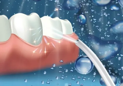 Global Oral Irrigator Market to Reach $0.93 Billion by 2030, Growing at 5.8% CAGR
